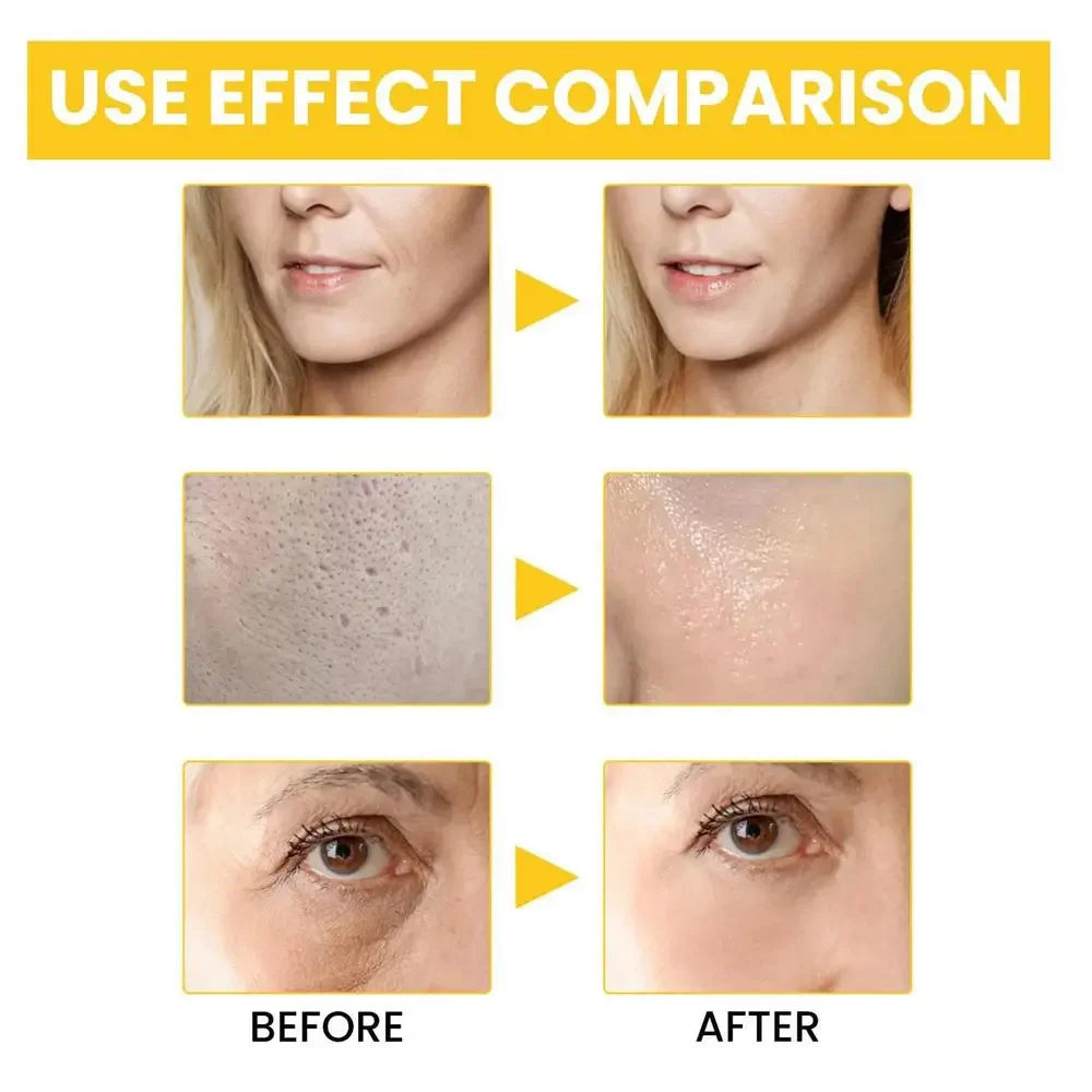 Retinol Anti-Wrinkle Serum Anti Aging Face Lifting Firming Fade Fine Lines Moisturizing Skin Care Hyaluronic Acid Facial Serum - Deals Today