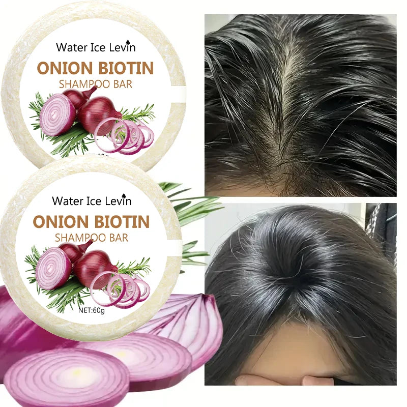 Onion and Biotin Shampoo Soap - 60g, Suitable for All Hair Types, Moisturizing and Smoothing, Rich in Rosemary Extract - Deals Today