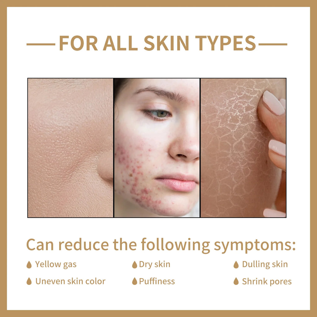 EELHOE Rice Toner for Face Brightening Serum Oil Control Moisturizing Facial Smooth Sensitive Skin Care Pore Shrinking Essence - Deals Today